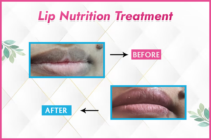 amista before and Lip Nutrition