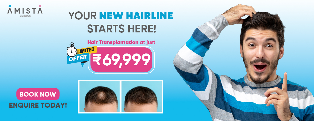 Hairline 1300x500_2